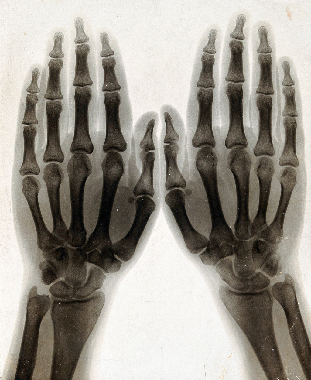 Női ujjatlan magas nyakú body (Arthur Schuster - Hands)